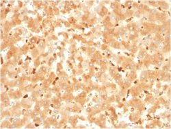 alpha 2-Macroglobulin Antibody (A2M/3621) - Azide and BSA Free, Novus Biologicals 100 &mu;g | Buy Online | Novus Biologicals | Fisher Scientific